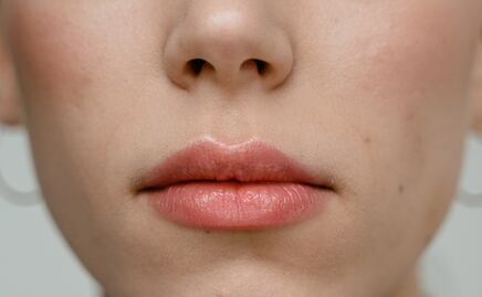 Soluciones para decir adiós a los labios agrietados