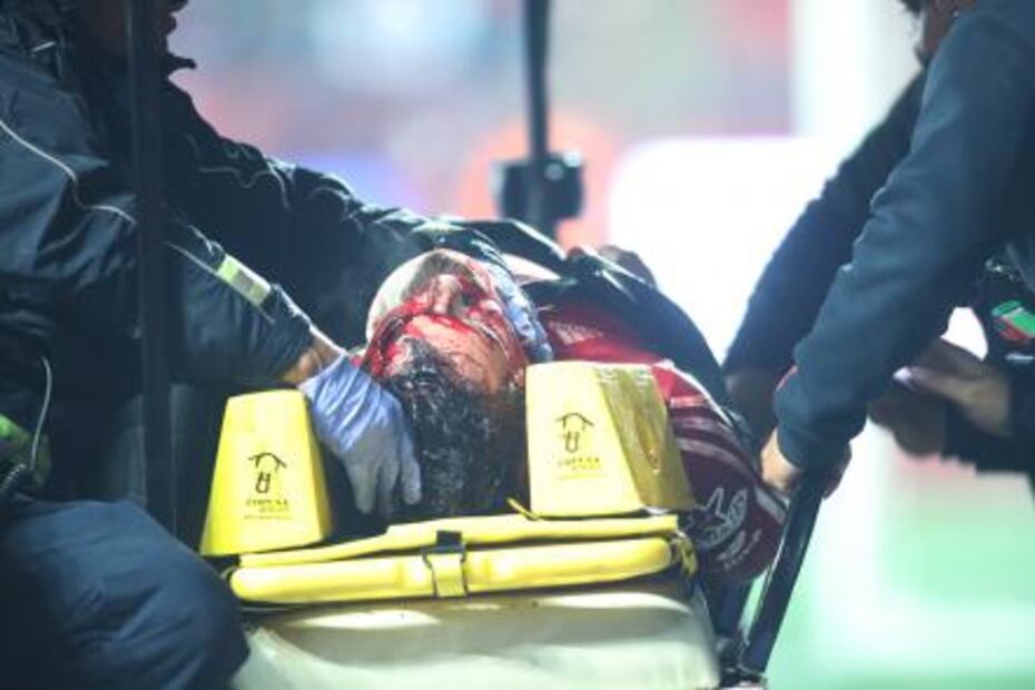 Brutal accidente en el estadio de Xolos
