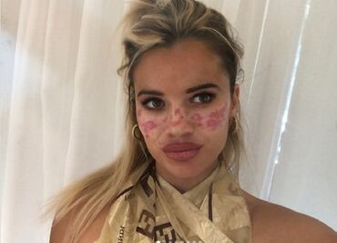 Modelo arruina su cara con tutorial de TikTok para tener pecas