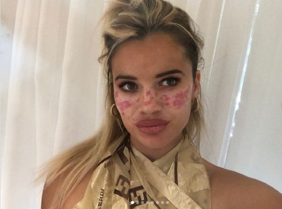 La modelo Tilli Whitfeld arruinó su cara usando tinta y agujas / Foto: instagram.com/tillywhitfeld