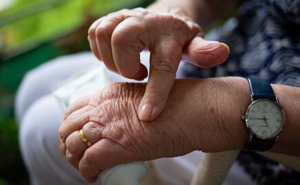 El árbol que alivia las enfermedades inflamatorias crónicas como la artritis