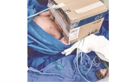 A falta de equipo, médicos optan por la improvisación