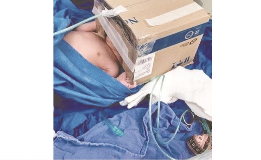 Médicos del país mostraron en redes sociales cómo, a falta de insumos y equipo especializado, atienden a los pacientes para salvarles la vida. TOMADAS DE REDES SOCIALES