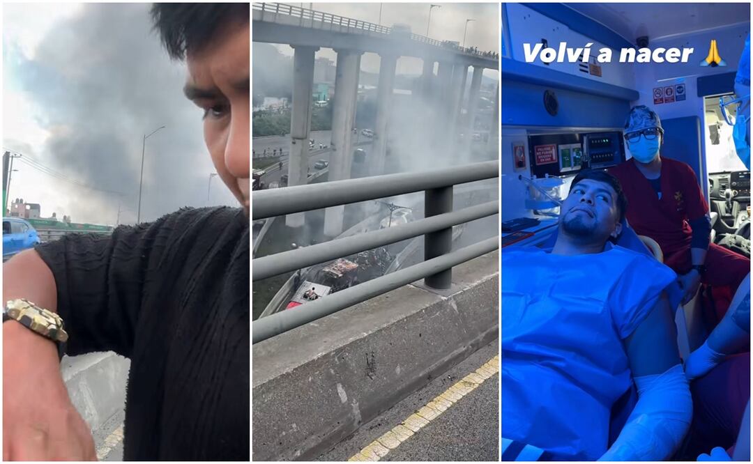 El influencer sufrió quemaduras en ambos brazos. Foto: Redes Sociales