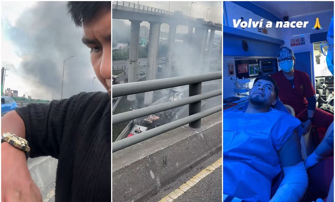 El influencer sufrió quemaduras en ambos brazos. Foto: Redes Sociales