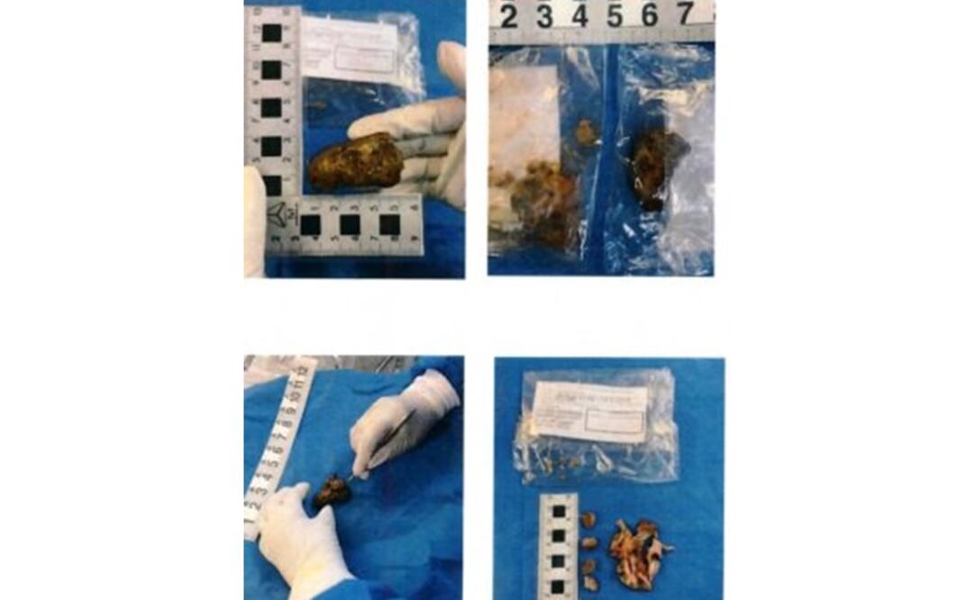 Foto: Twitter @FGE_Veracruz