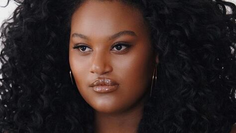 La mujer con labio leporino y paladar hendido que posó para Vogue y se convirtió en modelo