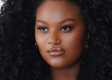 La mujer con labio leporino y paladar hendido que posó para Vogue y se convirtió en modelo