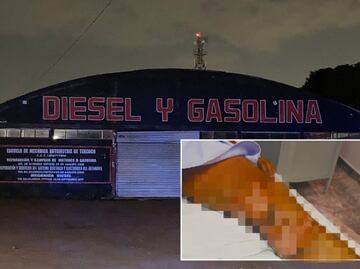 Bullying: Prenden fuego a Cristian, estudiante de mecánica en Texcoco; responsables serían sus propios compañeros