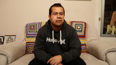 El hombre que vive con tres balas en la cabeza