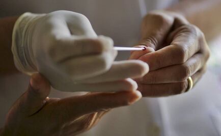 Dos hospitales de EU crean una prueba rápida del zika