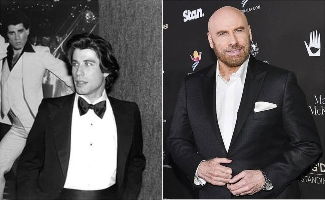 Una de las sustancias de las que más abusan famosos como Travolta es el botox.