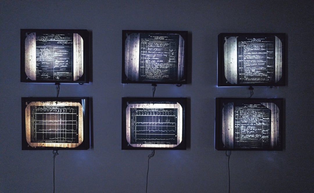 Algunos documentos de la estancia de Frida Kahlo en el hospital American British Cowdray —hoy Centro Médico ABC—, se exhiben por primera vez al público en la exposición Kahlo sin fronteras, en la Casa Estudio Diego Rivera. Foto: Yaretzy M. Osnaya | El Universal