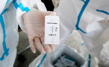 ¿Cuáles son los tests de antígenos, capaces detectar Covid-19 en minutos?