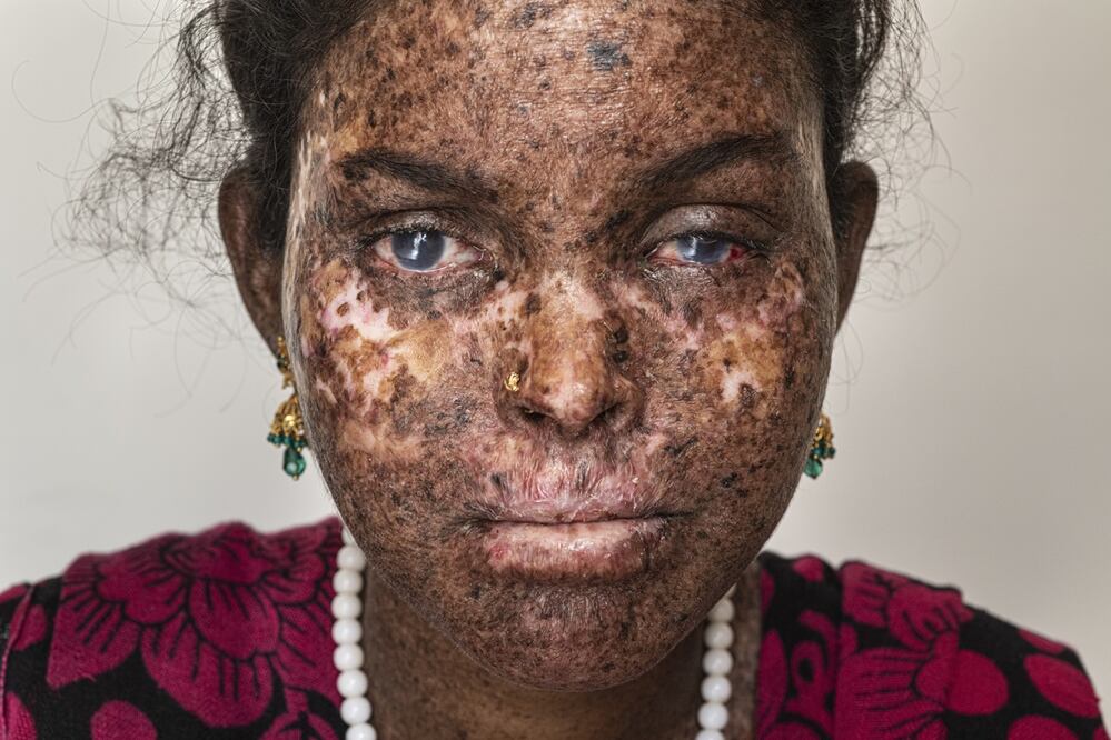 Foto: Fundación Tej Kohli