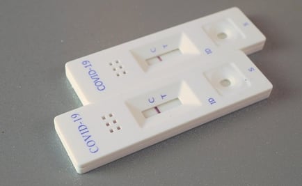 Test de saliva para detectar el Covid-19 triunfa en Austria