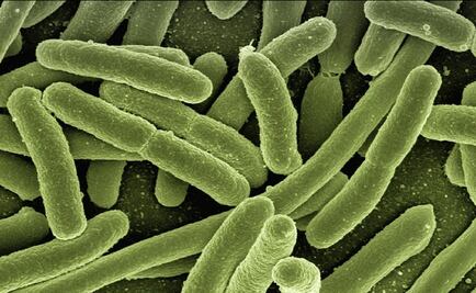 Detectan dos posibles casos de fiebre de Marburgo, similar al ébola, en Ghana