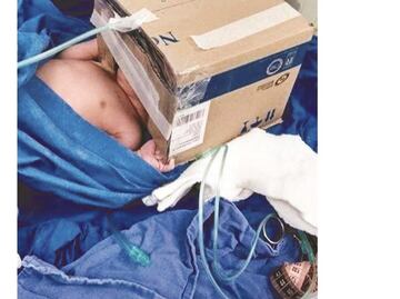 Mexican doctors improvise to save lives