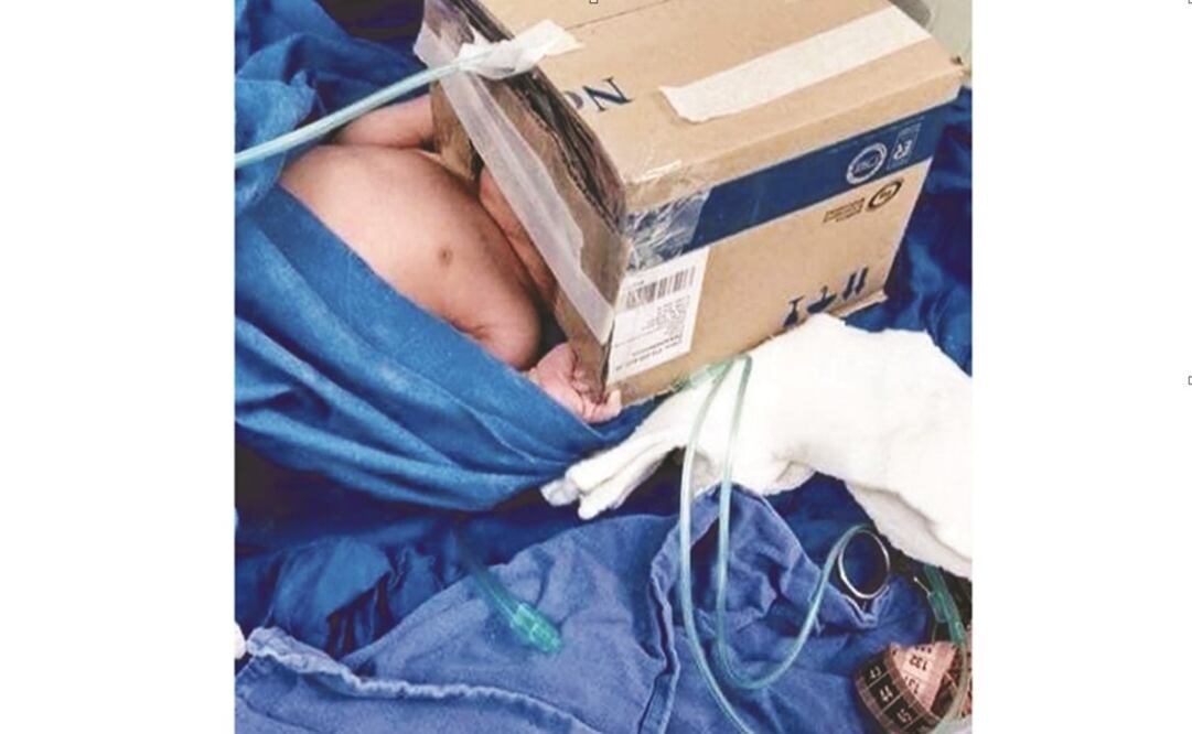 Images of different objects being used as medical supplies went viral - Photo: Taken from social media