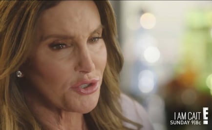 Caitlyn Jenner y la cirugía definitiva para cambiar de sexo