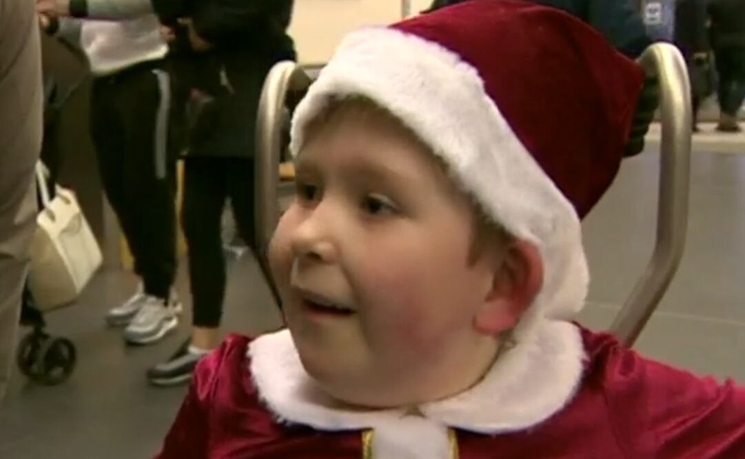 Noah nació con solo el 2% del cerebro (Foto: BBC)