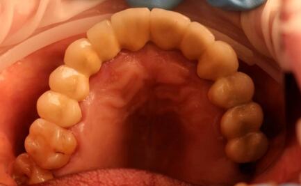 Descubren cómo es que los dientes perciben el frío