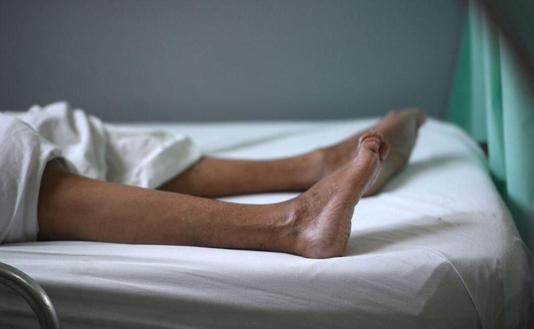 Perú ya ha declarado emergencia sanitaria por brote del síndrome Guillain-Barré. Foto: Archivo/ EL UNIVERSAL