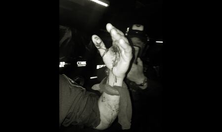 Policía de CDMX se dispara accidentalmente en la mano