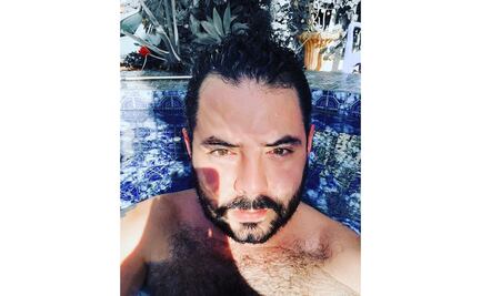 Ni el Covid le quitó el cigarro a José Eduardo Derbez