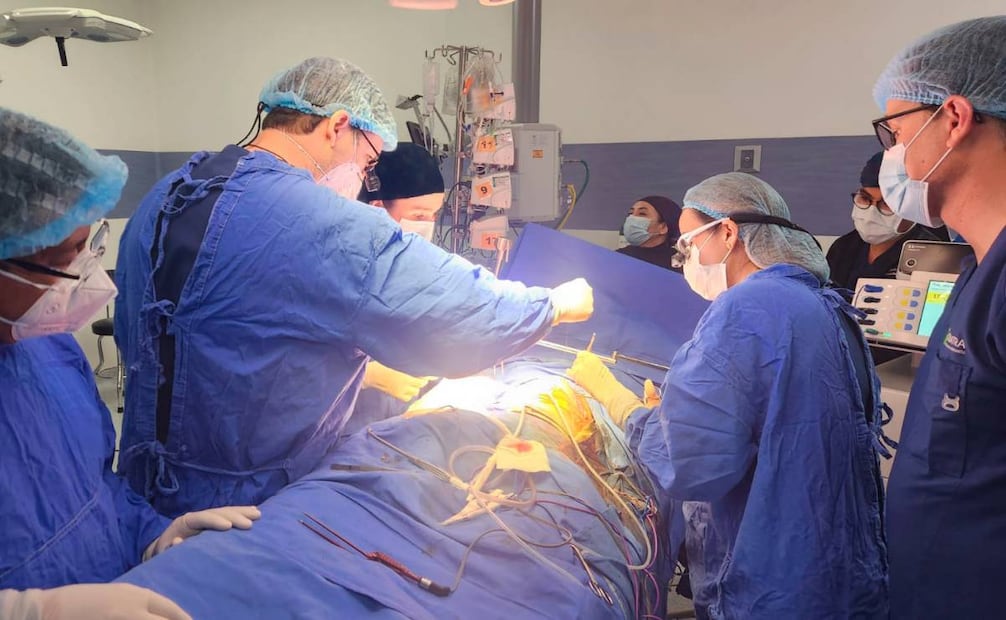 Aspectos del primer trasplante hepático a una menor de tres años, relacionado con hepatectomía asistida por cirugía robótica Da Vinci. Foto: Especial