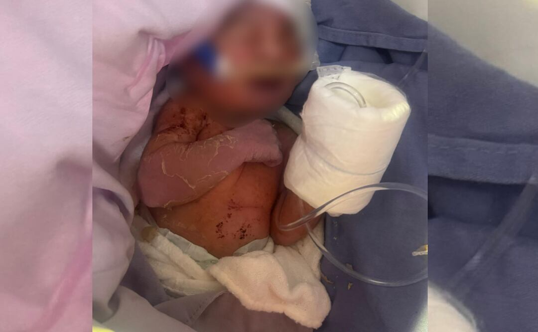 Hallan a bebé recién nacida abandonada en la vialidad pública de Ciudad Azteca (23/05/2025). Foto: Especial