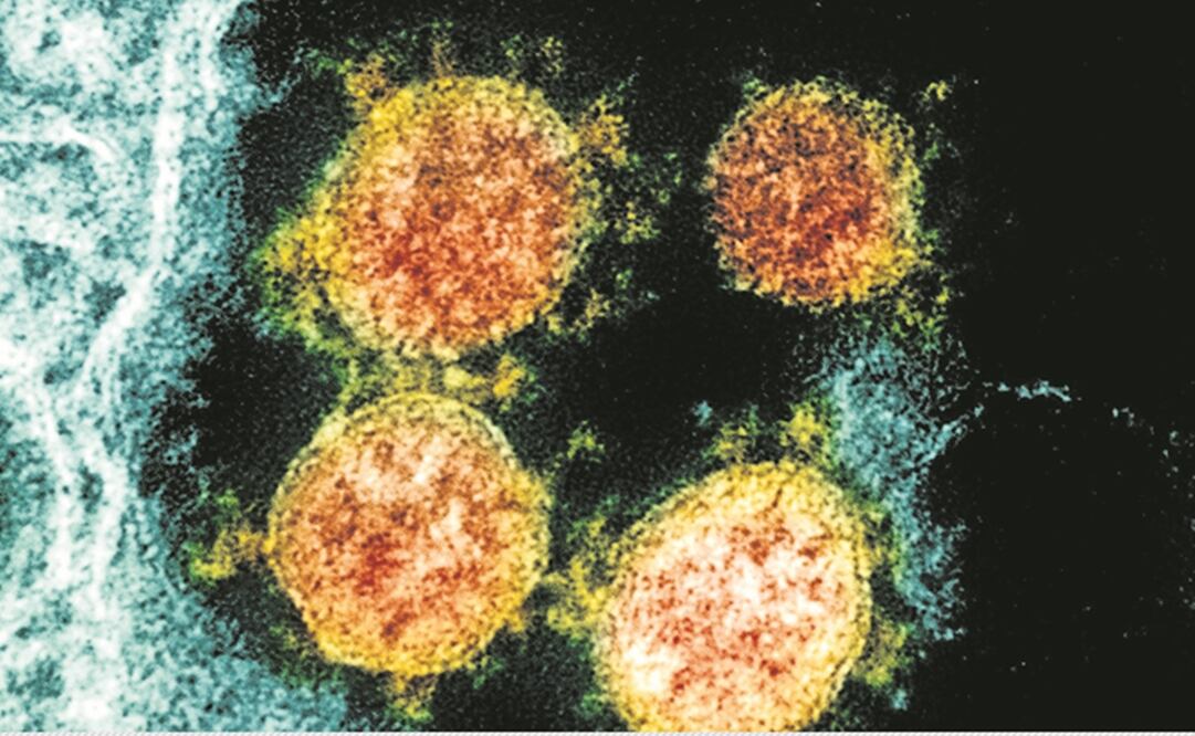 Foto: NIAID/National Institutes of Health via AP