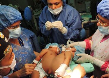 En medio de crisis de salud, separan a siamesas en Venezuela