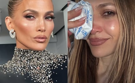 Jennifer Lopez se lastima el rostro en ensayo de los American Music Awards 2025; muestra el resultado en redes