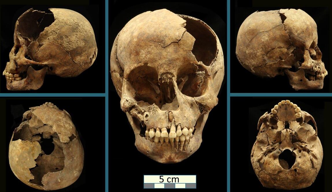 Restos fósiles de dos niños hallados al norte de la Ciudad de México.
Foto: INAH