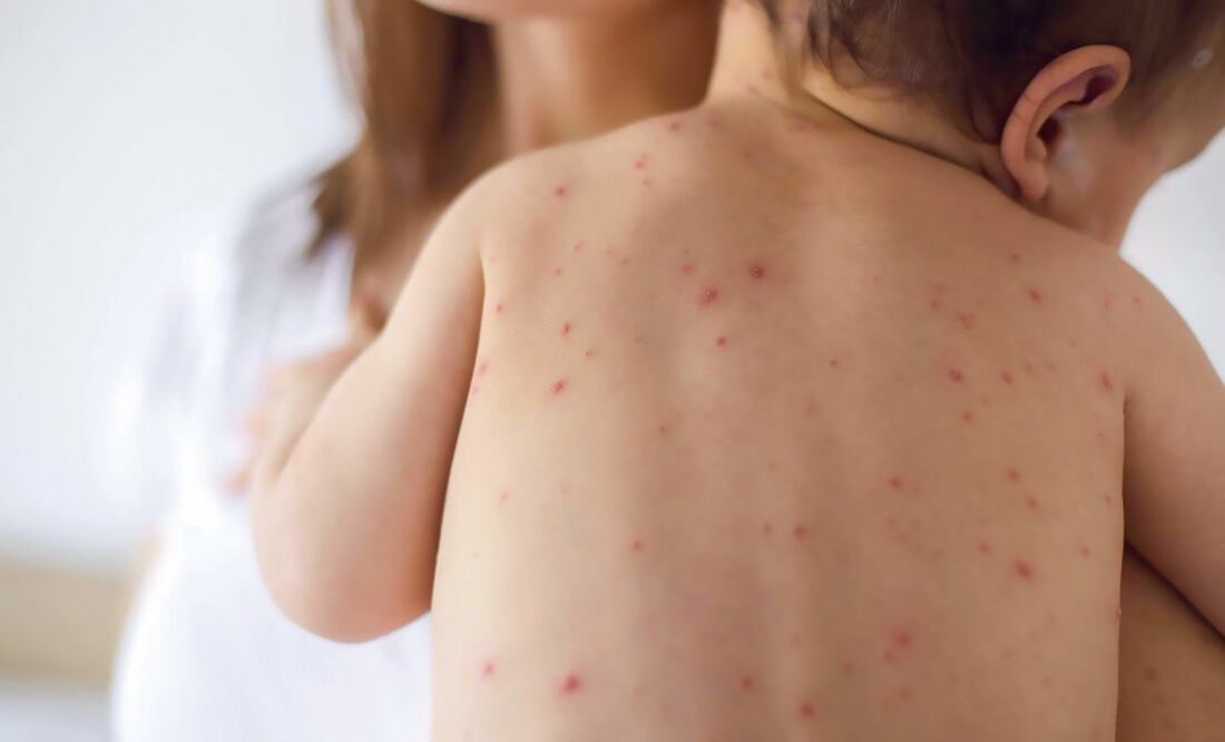 Fotografía: Archivo/EL GRÁFICO