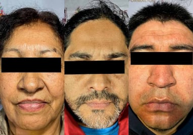 Caen Israel “N”presunto líder de facción de "Los 300" y 4 personas más, tras cateos en Iztapalapa y la GAM; aseguran 400 dosis de droga