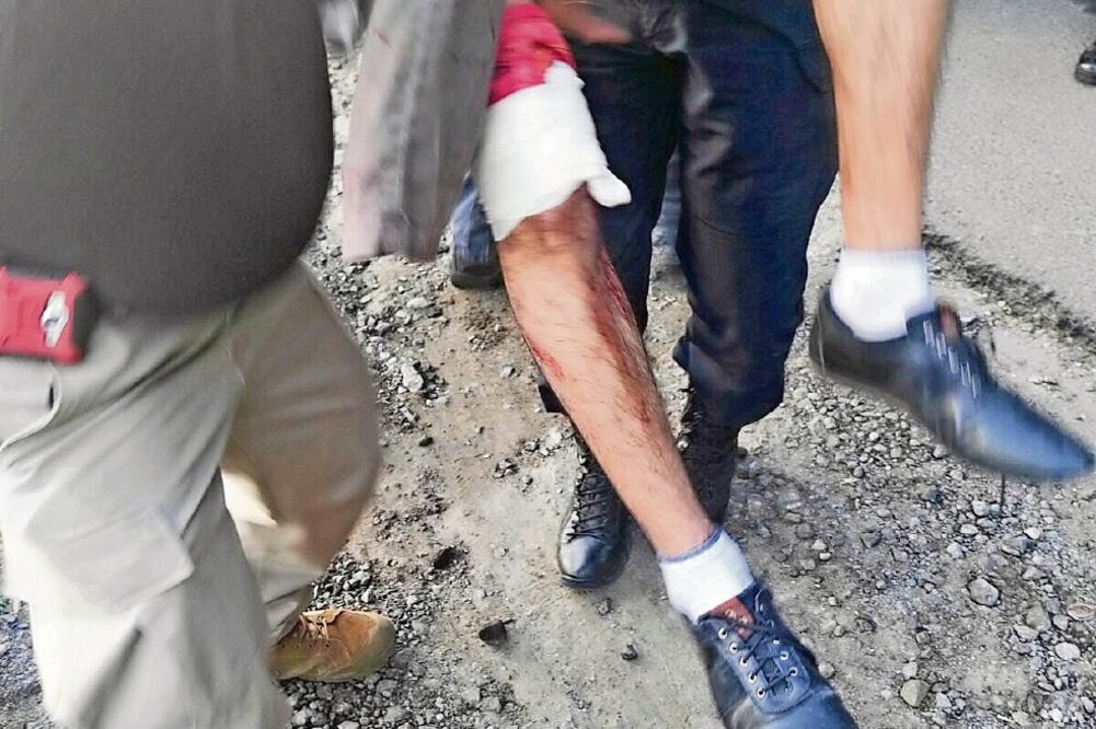 Paramédicos de Protección Civil acudieron al lugar para brindar atención médica a los lesionados (FOTO: ARCHIVO EL UNIVERSAL)