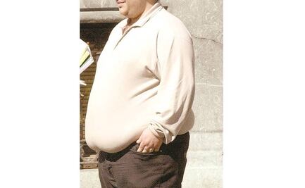 OMS: al año mueren 41 millones por obesidad