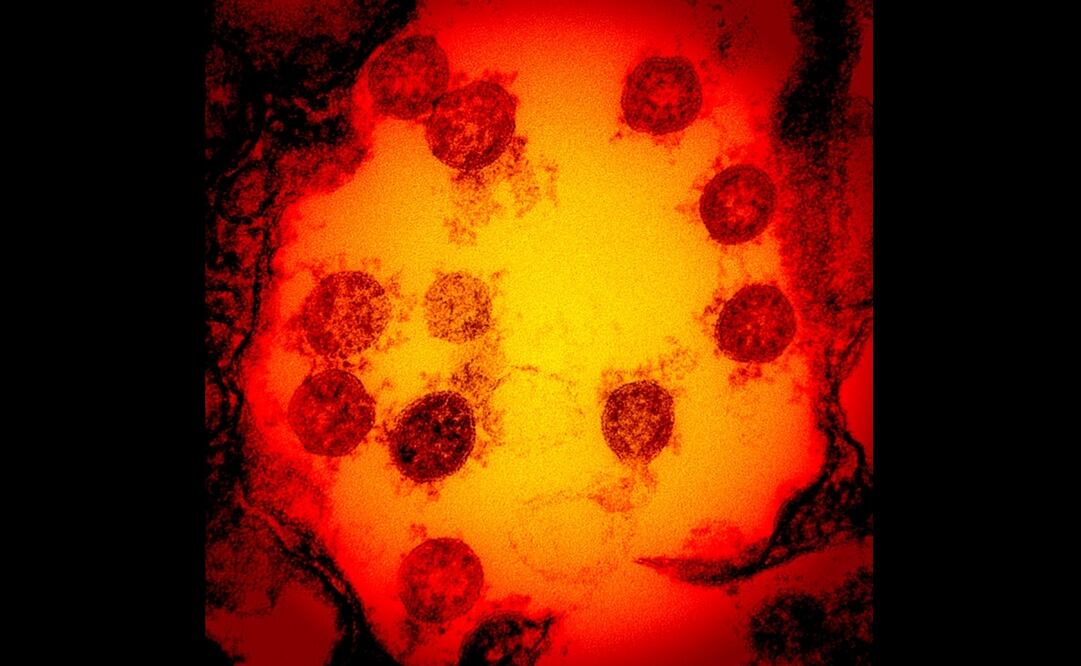 Foto: Handout / National Institute of Allergy and Infectious Diseases / AFP