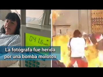 “Quieren utilizar esta agresión para separar el movimiento”: fotógrafa de EL UNIVERSAL agredida