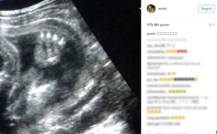 Anahí comparte imagen de ultrasonido