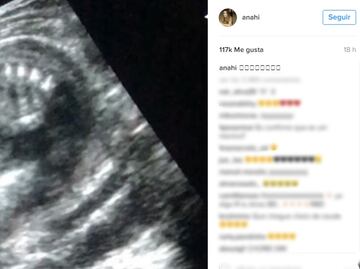 Anahí comparte imagen de ultrasonido
