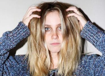 "Pensé que iba a ser grave", dice Natasha Dupeyrón tras caer de las escaleras