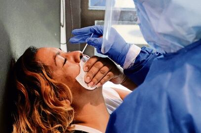 Pacientes recuperados de Covid grave podrían desarrollar autoanticuerpos y estar más expuestos a otras enfermedades