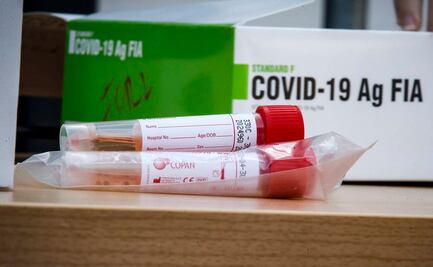 Italia supera por primera vez los 30 mil contagios de Covid-19 en un día