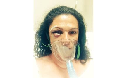 Relata Ana Guevara agresión; investiga PGR