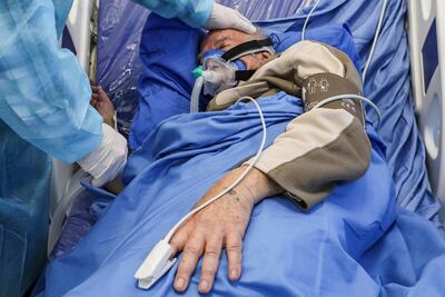 Un "huracán" de citocinas en pulmones agrava el Covid-19, según estudio