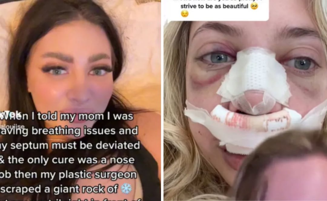 Le mintió a su madre para que pagara su cirugía plástica. Foto: TikTok @realavalouiise