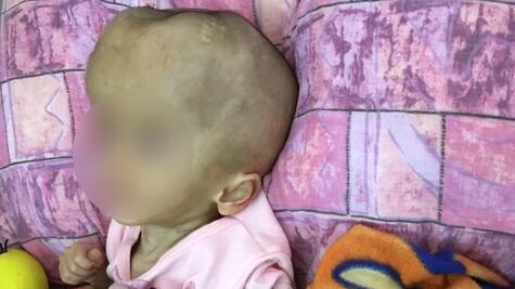 Crisis en Venezuela: "Le dieron un año de vida, pero ahí sigue"